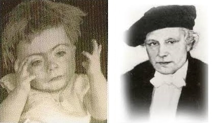 <p>On the left is the first known photograph of a child with Cornelia de Lange.  On the right is Professor Cornelia de Lange who described the syndrome in 1933.</p>